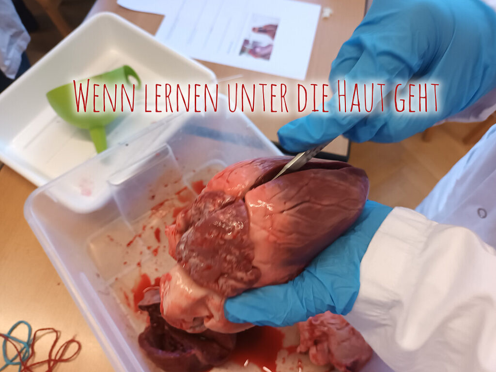 Heart dissection activity
