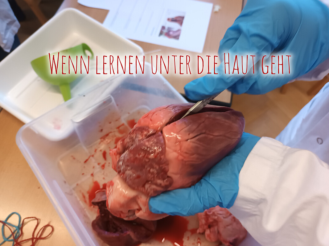 Heart dissection activity